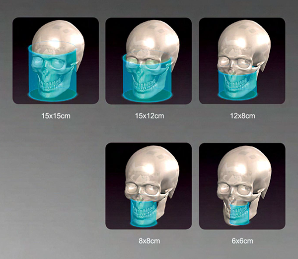 NewTom VGi口腔技術