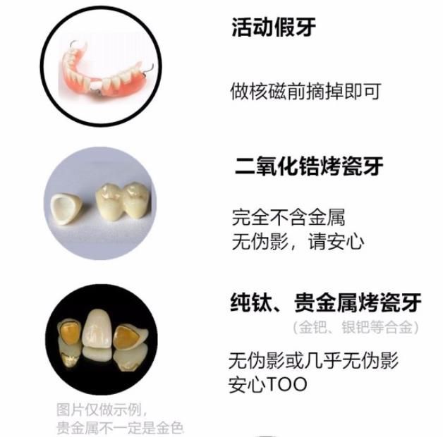 氧化鋯全瓷牙可以做核磁共振嗎
