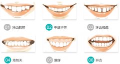 深圳哪個醫院牙齒不齊矯正好