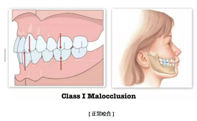 正常狀態牙齒閉合圖