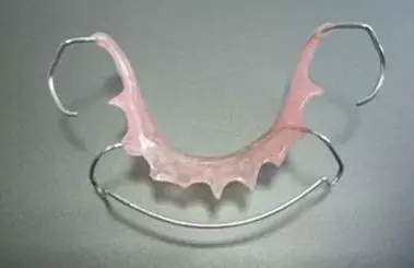 沒好好戴保持器，牙齒反彈了怎麽(me) 辦