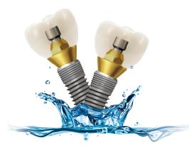 美國bicon多少錢