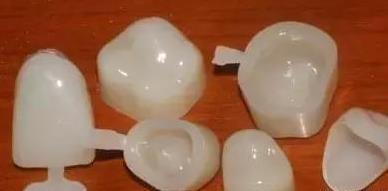 臨(lin) 時牙質量好不好,能佩戴多久