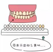 牙齒多久時間可以美白