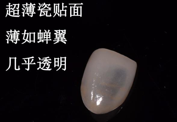 瓷貼麵掉了重新做