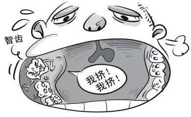 智齒把牙齒擠歪了，拔除智齒後會(hui) 變好嗎