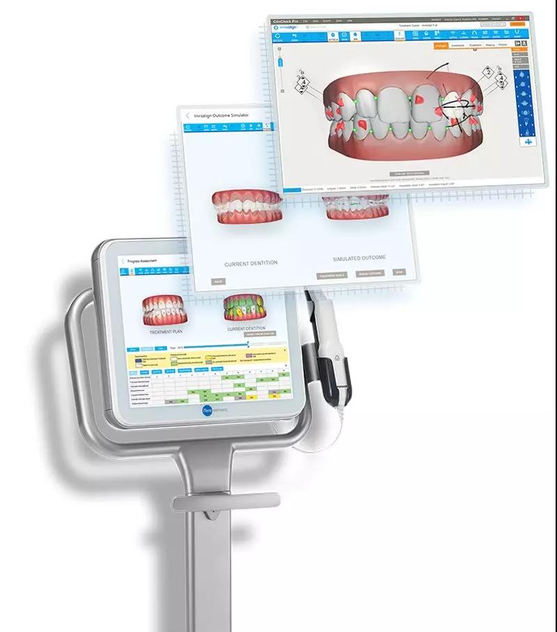 深圳做牙齒矯正可以分期付款嗎