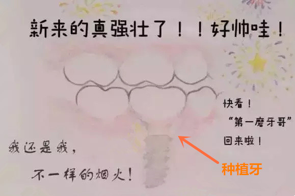 產(chan) 後幾個(ge) 月，可以拔牙和種植牙嗎