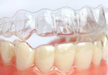 牙齒有牙縫可以帶牙套嗎