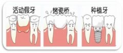 鑲牙去醫院還是診所