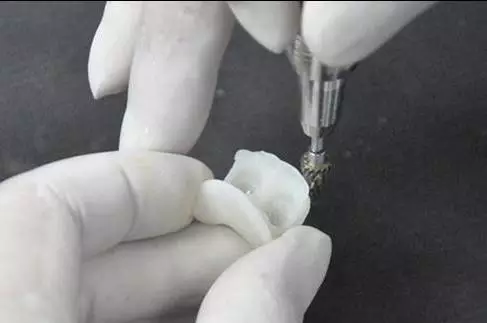臨(lin) 時牙是長這樣的