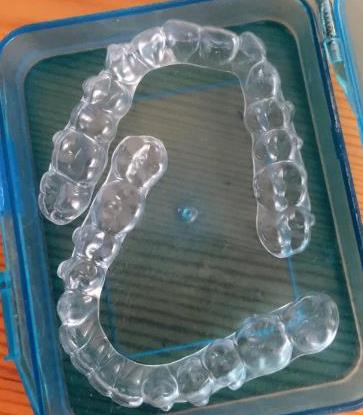 時代天使牙套多少錢,時代天使價(jia) 格