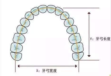 牙齒擁擠