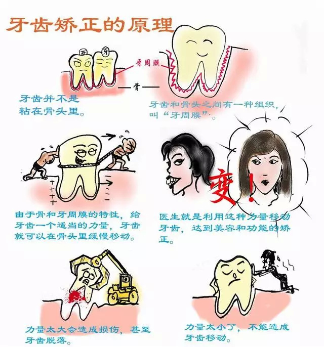 該怎樣看待兒(er) 童牙齒矯正？