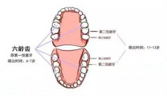 一顆牙做窩溝封閉的時間和價格