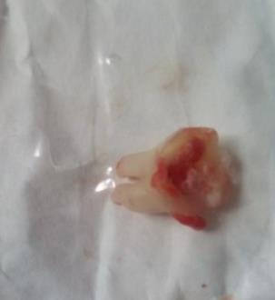 深圳拔牙技術有哪些優(you) 勢