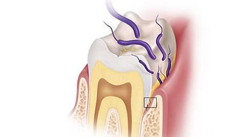 深圳哪個(ge) 醫院可以洗牙