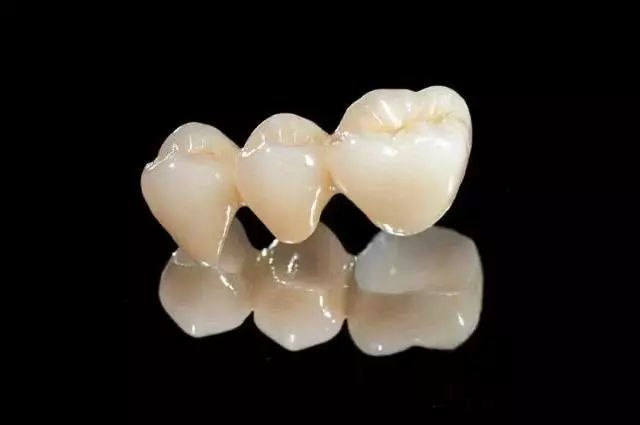 二氧化鋯全瓷牙