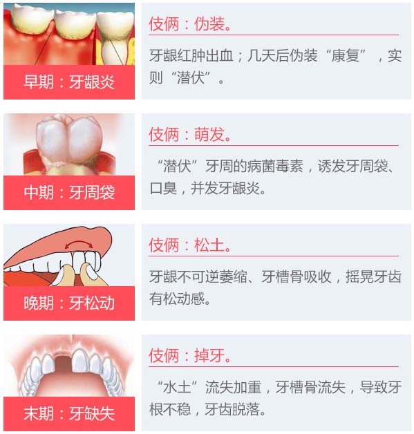 牙齦炎到牙周炎的發展過程