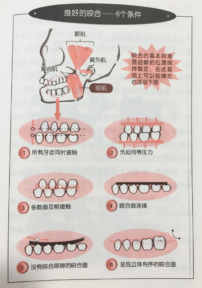 標準咬合6個(ge) 條件