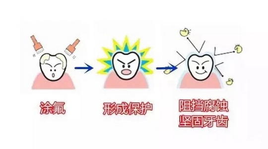 塗氟
