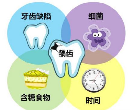 出現蛀牙的因素