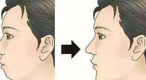 麵型改善