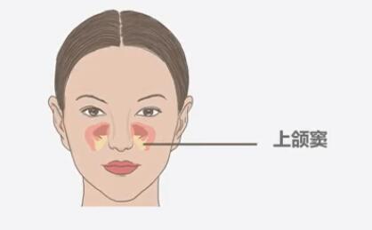 上頜竇