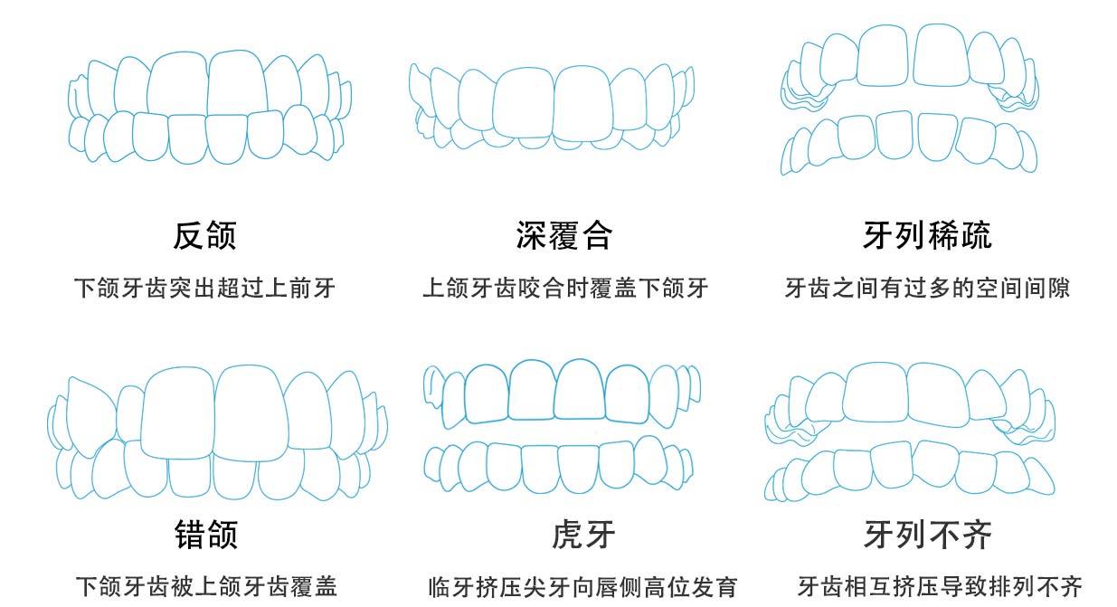 常見的牙齒畸形