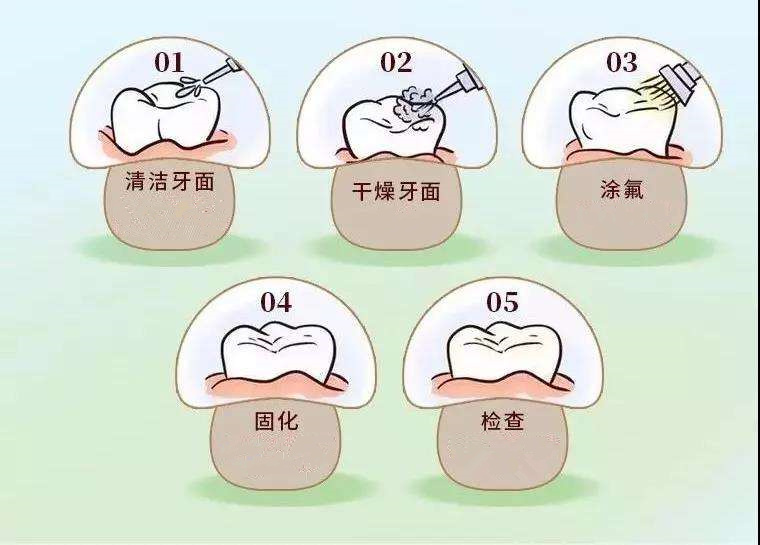 塗氟的操作過程