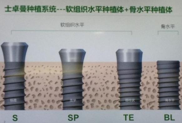 瑞士Straumann種植體(ti) 
