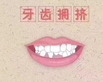 牙齒擁擠