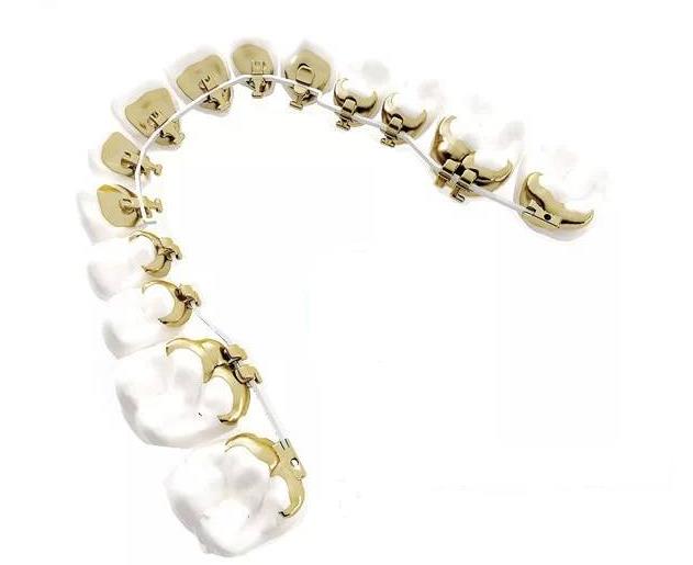 Incognito舌側(ce) 矯治