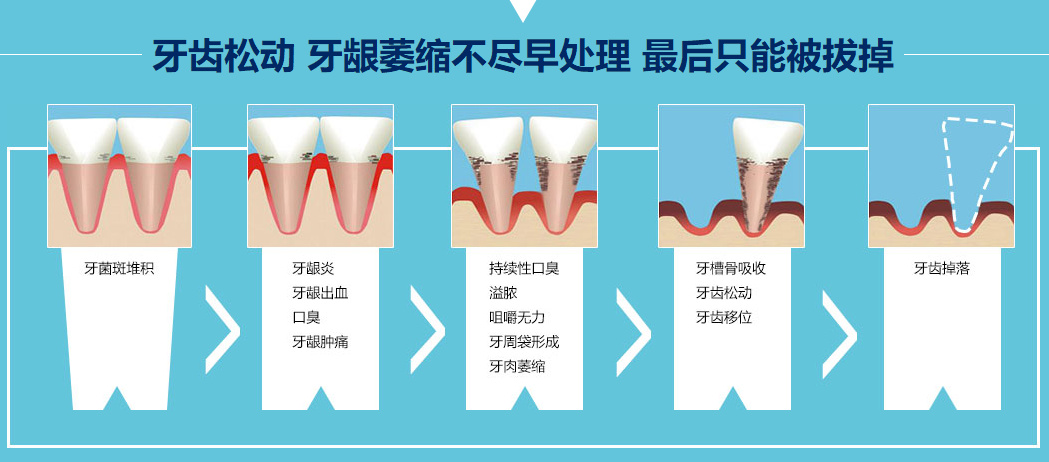 牙齒鬆動和牙齦萎縮的危害