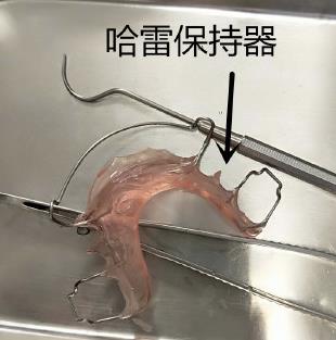 哈雷保持器看起來