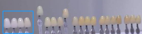 好萊塢白是這樣的