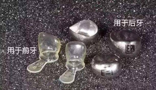 兒(er) 童預成冠