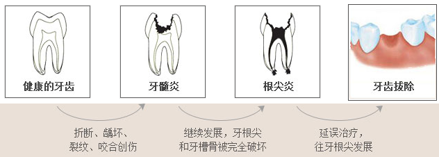 健康的牙齒到拔牙