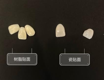 樹脂貼麵和瓷貼麵
