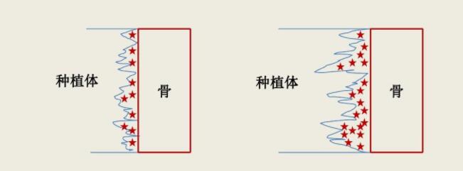 種植體(ti) 不同表麵和牙槽骨的結合