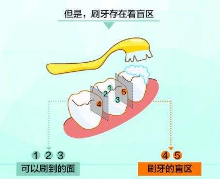 刷牙盲區