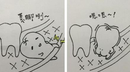 智齒