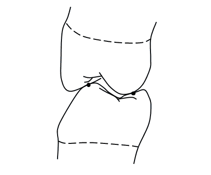 正常咬合的牙齒