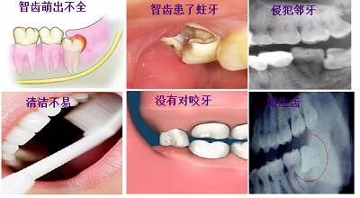 智齒這些情況