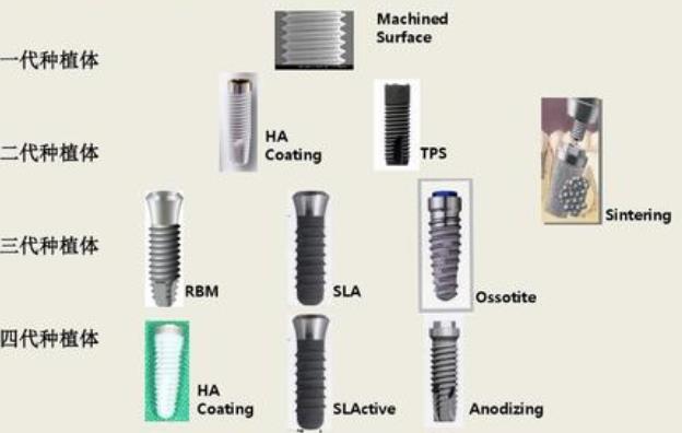 種植體(ti) 表麵處理技術