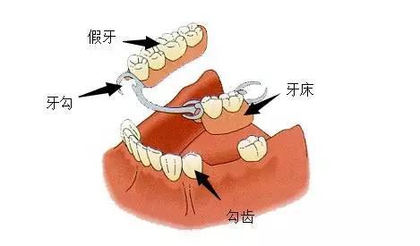 活動義(yi) 齒的結構示意