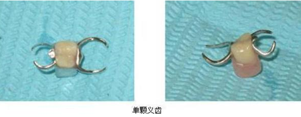 單顆義(yi) 齒
