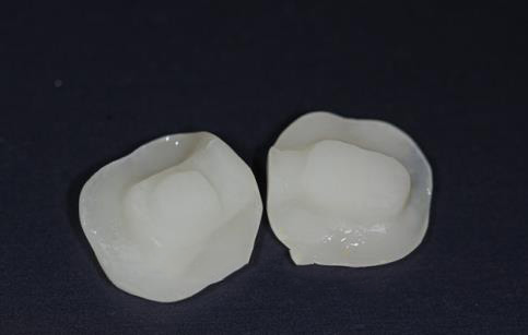高嵌體(ti) 的樣子