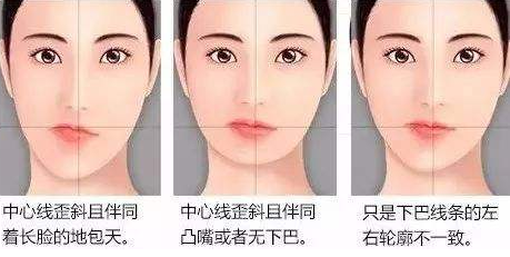 偏頜