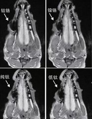 不同的材料會(hui) 對核磁共振產(chan) 生偽(wei) 影